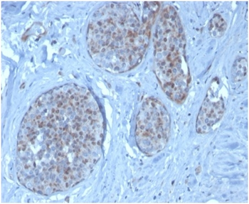 MDM2 Antibody