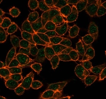 CBFB Antibody