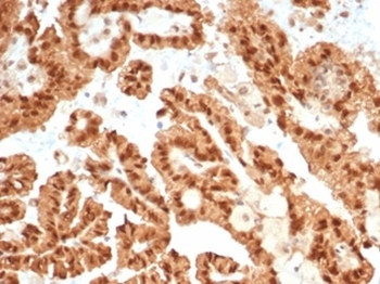 Recombinant STAT6 (Solitary Fibrous Tumor Marker) Antibody