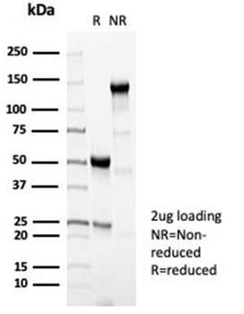 Recombinant Perforin-1 (Pore Forming Protein) (Apoptosis Marker) Antibody