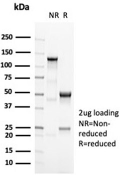 Recombinant OCT-2 (POU2F2) (B-Cell Marker) Antibody