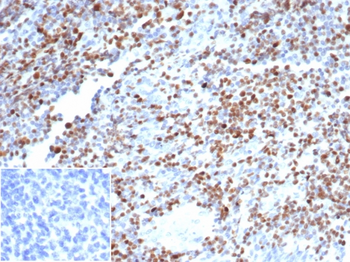 Recombinant OCT-2 (POU2F2) (B-Cell Marker) Antibody