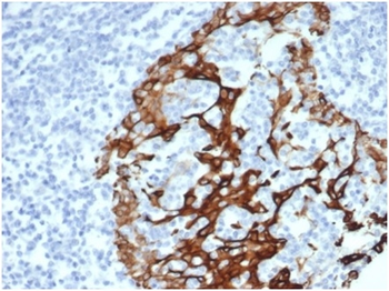 KRT6A Antibody