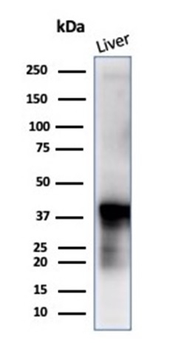 GLUL Antibody