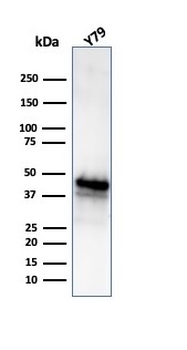GLUL Antibody