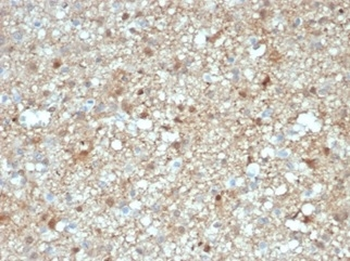 S100B Antibody