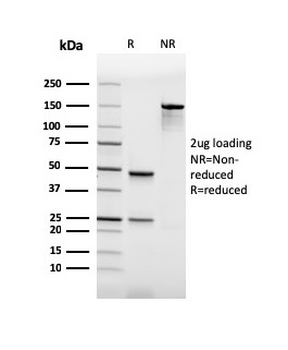 SPI1 Antibody