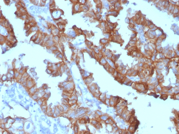 Ep-CAM / CD326 (Extracellular Domain) (Epithelial Marker) Antibody