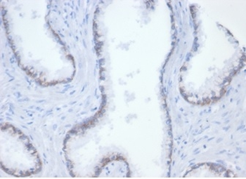 CTNNB1 Antibody