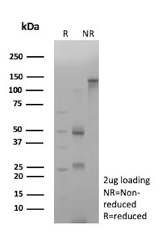 CTNNB1 Antibody