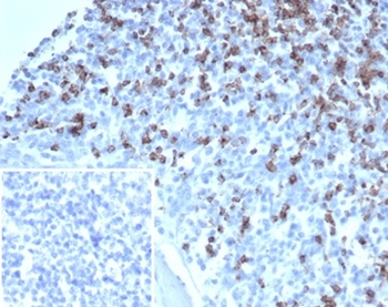 CD2 Antibody