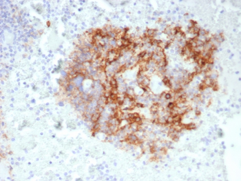 CR1 Antibody