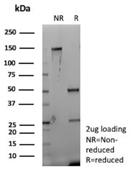 CR1 Antibody