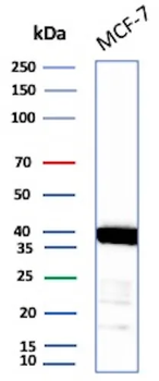 Recombinant EpCAM / CD326 (Epithelial Marker) Antibody