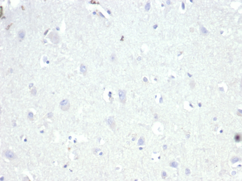 AMACR Antibody