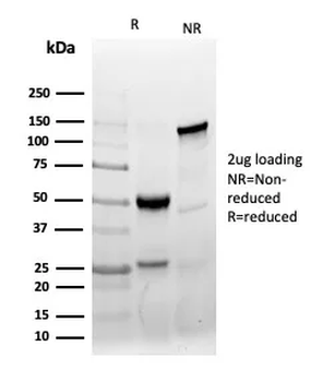 AMACR Antibody