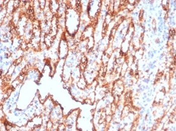 CD36 (Platelet & Microvessel Marker) Antibody
