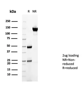 CD36 (Platelet & Microvessel Marker) Antibody