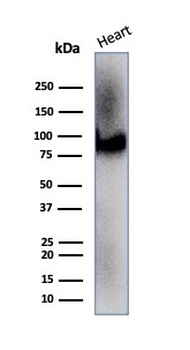 CD36 (Platelet & Microvessel Marker) Antibody