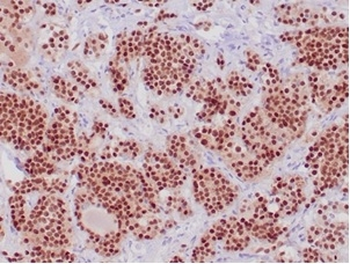 POU1F1 Antibody