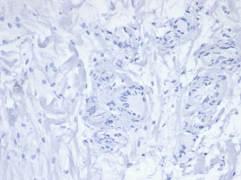 PDCD1 / PD1 / CD279 (Programmed Cell Death 1) Antibody