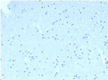 CD23 (Fc Epsilon RII) Antibody
