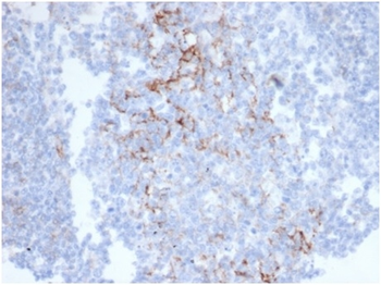 CD23 (Fc Epsilon RII) Antibody