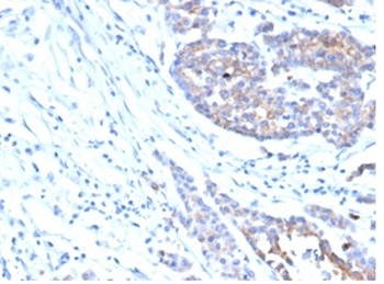IGF1R Antibody