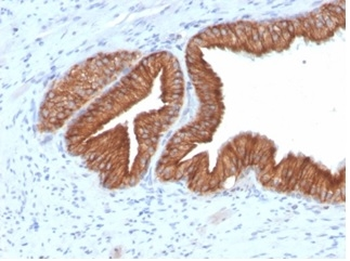 IGF1R Antibody