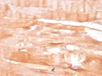 DMD Antibody