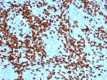 DNTT Antibody
