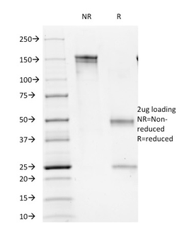 FCGR3A Antibody