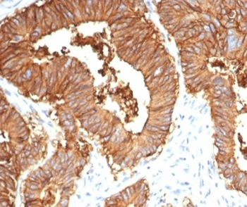 Recombinant EpCAM / CD326 (Cytoplasmic Domain) (Epithelial Marker) Antibody