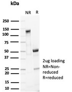 Recombinant EpCAM / CD326 (Cytoplasmic Domain) (Epithelial Marker) Antibody