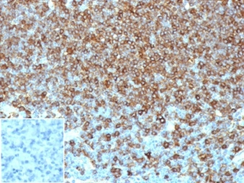 HLA-DPB1 Antibody