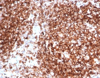 HLA-DPB1 Antibody