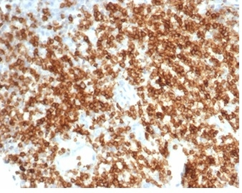 Recombinant CD6 (Negative Marker of T-regulatory Cells) Antibody