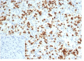 Recombinant CD6 (Negative Marker of T-regulatory Cells) Antibody