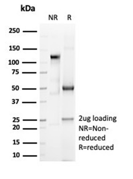 Recombinant CD6 (Negative Marker of T-regulatory Cells) Antibody