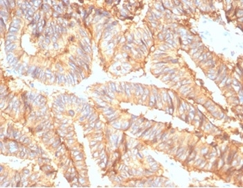 Recombinant EpCAM / CD326 (Epithelial Marker) Antibody