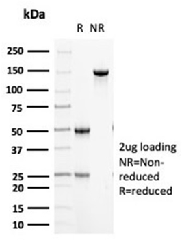 KRT5 Antibody