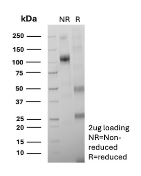 Recombinant Arginase 1 (Hepatocellular Carcinoma Marker) Antibody