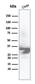 Recombinant Arginase 1 (Hepatocellular Carcinoma Marker) Antibody