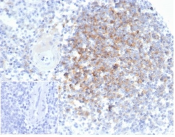 IFNA1, IFNA13 Antibody