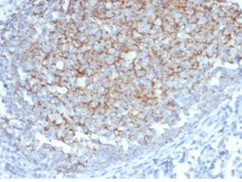 IFNA1, IFNA13 Antibody