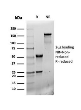 Recombinant CD31 / PECAM-1 (Endothelial Cell Marker) Antibody