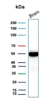 Recombinant GFAP (Astrocyte & Neural Stem Cell Marker) Antibody