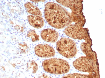 Recombinant TAG-72 / CA72.4 (Tumor-Associated Glycoprotein) Antibody