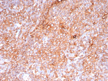 HLA-DPB1 Antibody