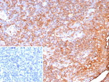 HLA-DPB1 Antibody